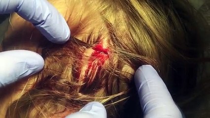 EMERGENCY STITCHES?!?