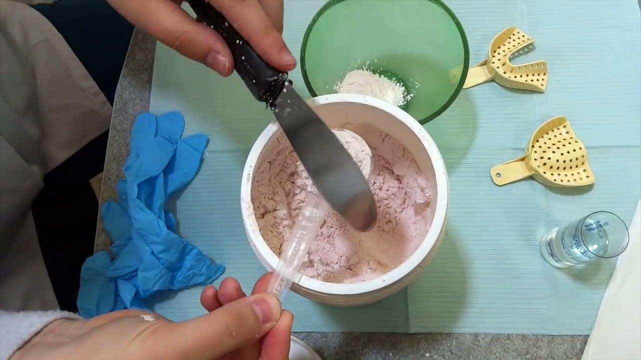 Taking an Awesome Alginate Impression