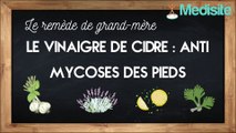 Remède de grand-mère anti-mycoses des pieds : le vinaigre de cidre