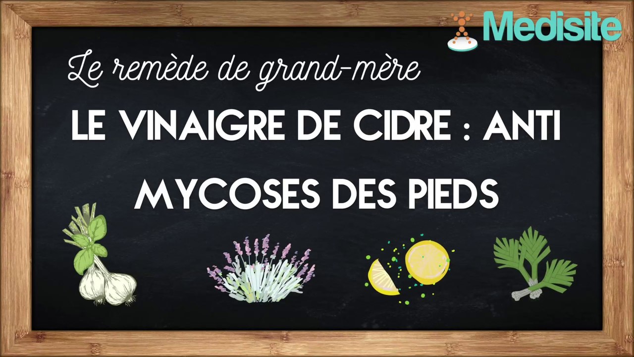 Remède de grand-mère anti-mycoses des pieds : le vinaigre de cidre
