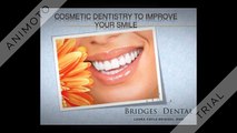 Dentist Brandon Cosmetic Dentistry to Improve Your Smile With Bridges Dental