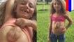 Girl born with heart outside chest: 8-year-old suffers from rare congenital condition - TomoNews