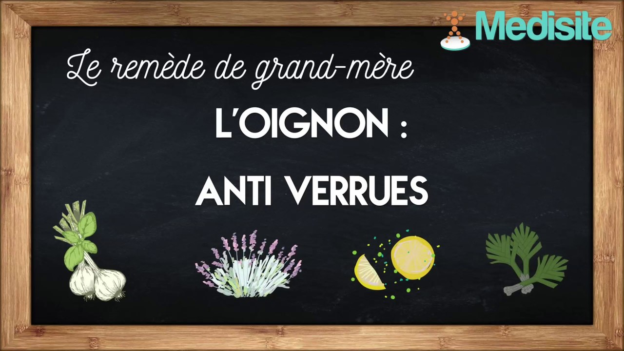 Le remède de grand-mère anti-verrues  : l’oignon