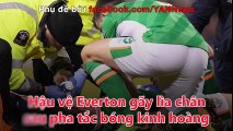 Hậu vệ Everton gãy chân sau pha tắc bóng kinh hoàng