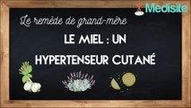 Le remède de grand-mère hypertenseur cutané : le miel