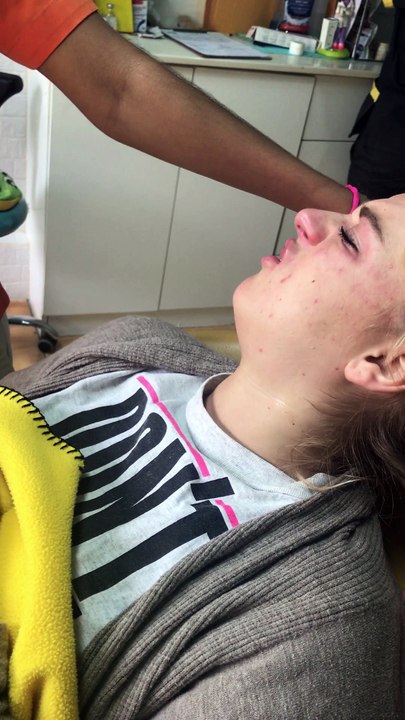 Wisdom Teeth Anesthesia