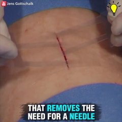 Avec cette invention fini les points de suture! Pansement révolutionnaire
