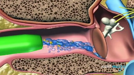 Another Top 10 Worst As Seen On TV Items Ever