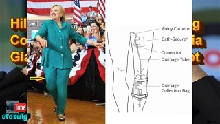 Hillary Clinton Colostomy Bag Cover-up.