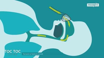 Comment fonctionnent les appareils respiratoires pour traiter l'apnée du sommeil ?