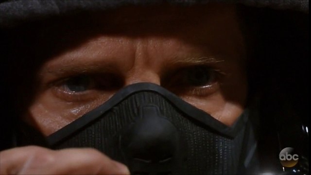 ARC2-091917 PT4 AvaPatient6SBEyes