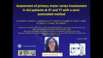 C32 Assessment of primary motor cortex involvement in ALS patients at 3T and 7T with a semi-automated method