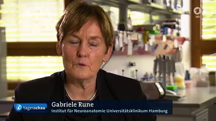 Forschungsstand bei der Volkskrankheit Demenz | Gut zu Wissen | Tagesschau24