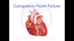 ✔ Congestive Heart Failure (CHF) Explained - MADE EASY