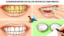 Guaranteed! Whiten Your Yellow Teeth In Less Than 2 Minutes