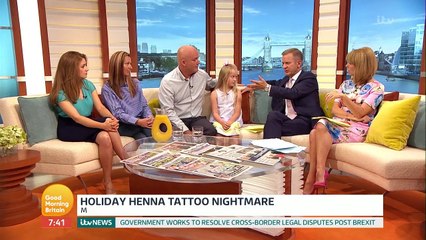 Black Henna Tattoo Scars Girl's Arm  Good Morning Britain