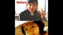 Top 20 Kpop Female Idols Before and After Plastic Surgery