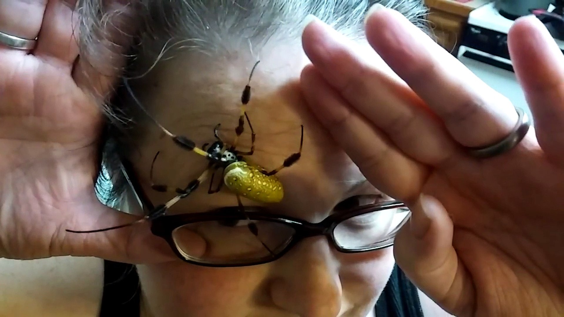 VIDEO. Ces micro-araignées pullulent sur votre visage