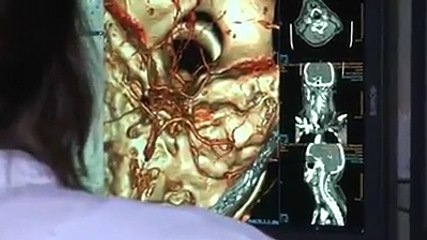 AVC      faites sauter le bouchon