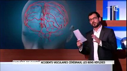 AVC  qu'est-ce que la thrombectomie