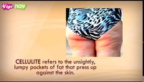How to Get Rid of Cellulite on Thighs - Intro, Causes, Cure Steps, From Easy to Advanced