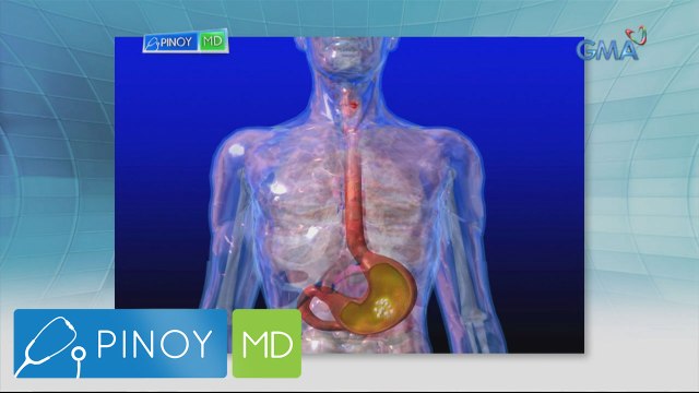 Pinoy MD: Hyperacidity, paano nga ba maiiwasan?