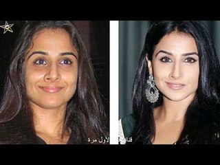 ممثلات هولويد قبل وبعد التجميل لن تصدق سوف تنصدم