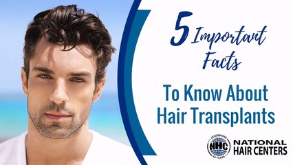 5 Important Facts To Know About Hair Transplants