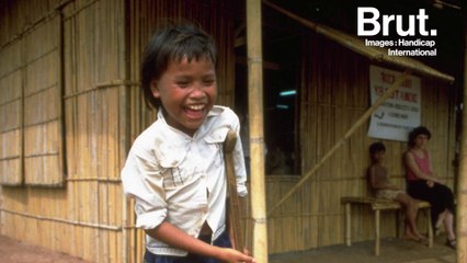 Gnep Smoeun, première enfant soignée par Handicap International