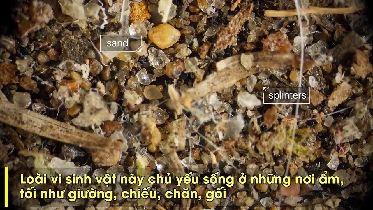Giật mình choáng váng trước loài vi sinh vật ăn da chết khiến 1,2 tỷ người bị dị ứng