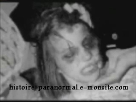 Voici les photos terrifiantes de la jeune fille qui a inspiré le film L'Exorcisme d'Emily Rose