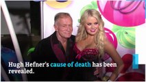 Report: Hugh Hefner's cause of death revealed