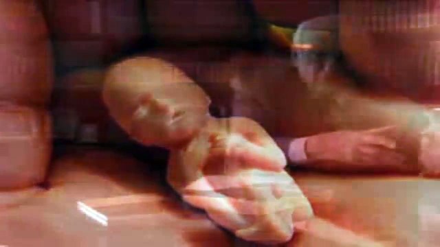 Ives Gandra - o Abortismo