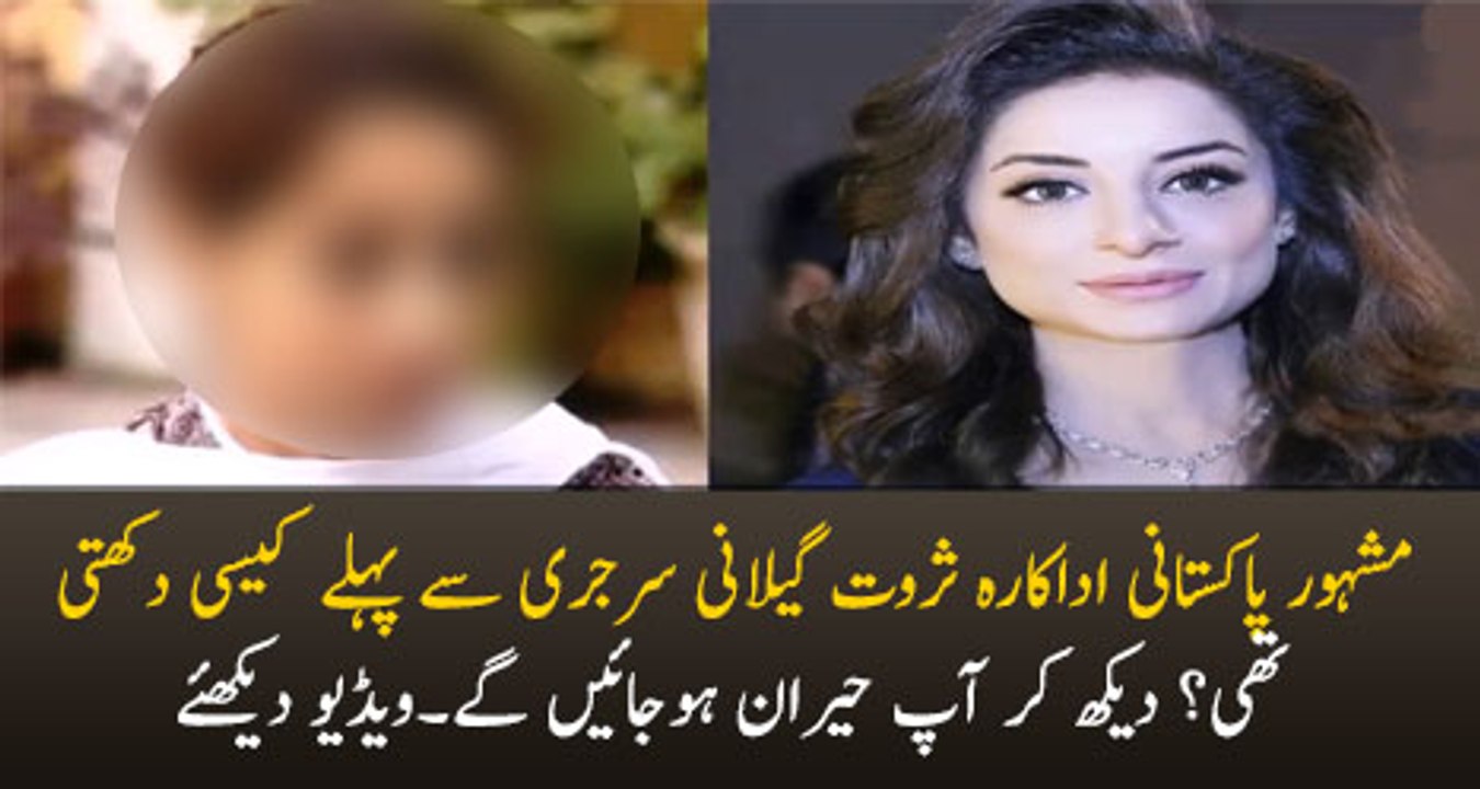 Sarwat Gillani Before and After Plastic Surgery