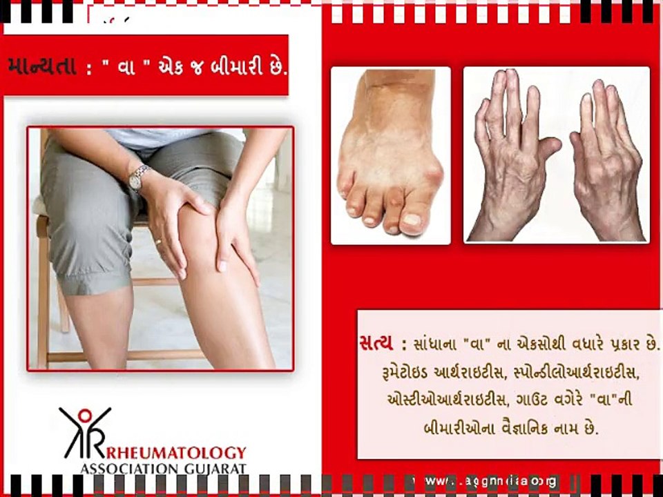 What is Arthritis? Know about Arthritis Symptoms and Treatment from RAG