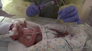 NICU Procedures- Nasogastric and orogastric tube placement
