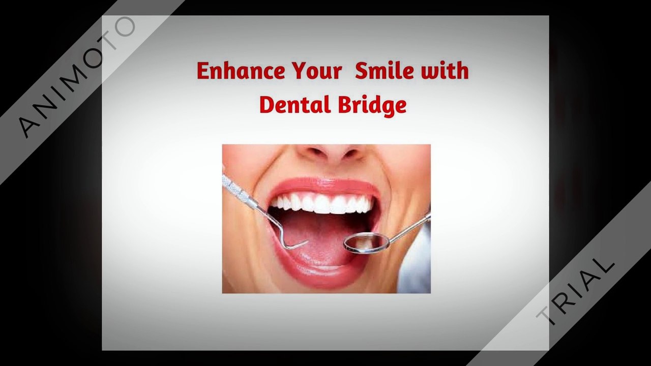 Female Dentist Lithia: Enhance Your Smile With Dental Bridge