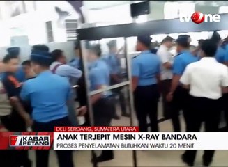 Geger, Tangan Bocah Terjepit di Mesin X-Ray Bandara