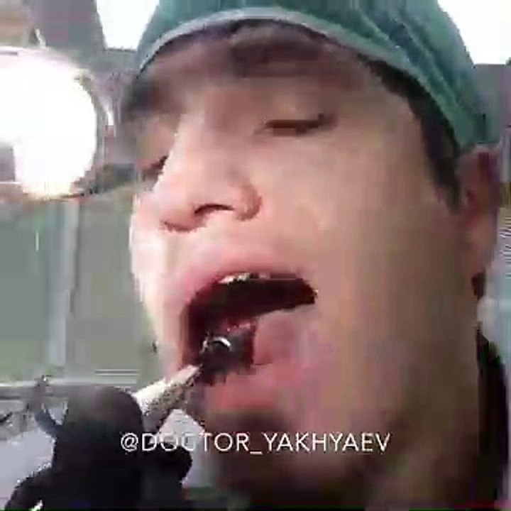 Ce dentiste russe s'arrache une dent de sagesse et poste la vidéo sur instagram