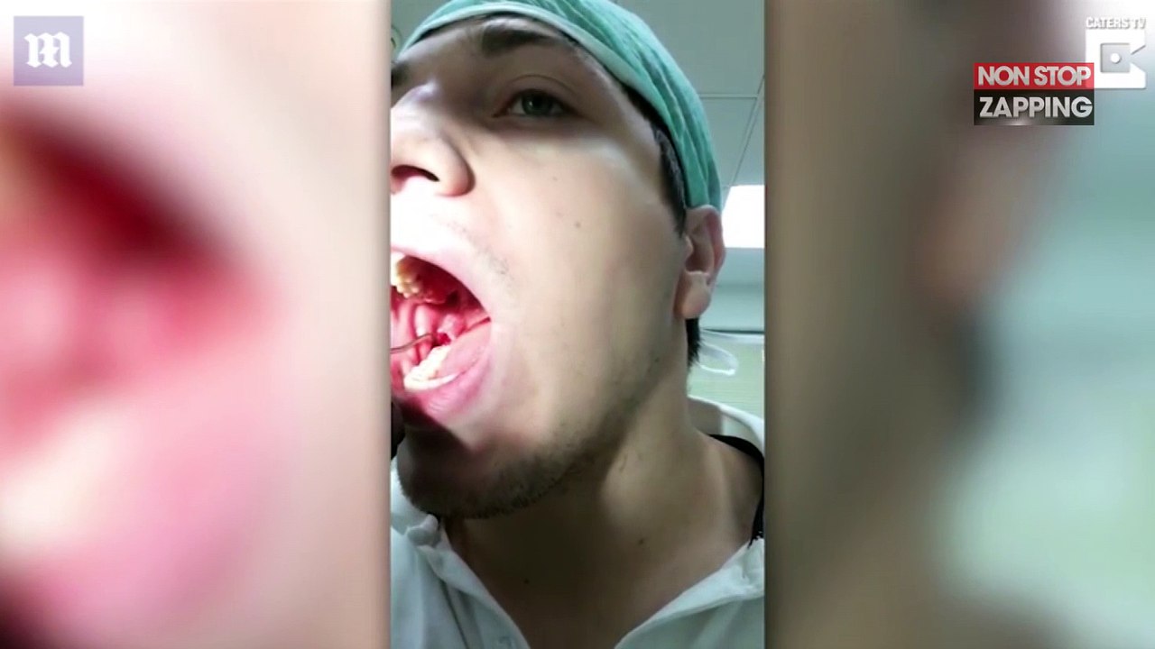 Russie : Les images chocs d’un dentiste qui s’arrache sa propre dent (Vidéo)