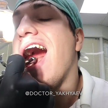 Un dentiste s'arrache une dent (Russie)