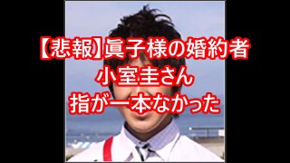 【悲報】眞子様の婚約者小室圭さん、指が一本なかった