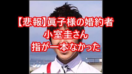【悲報】眞子様の婚約者小室圭さん、指が一本なかった