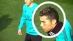 Ronaldo sports black eye at training