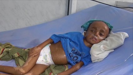 الأمم المتحدة توجه نداء للتبرع من أجل اليمن