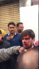 ਜਵਾਕ ਨੇ ਪ੍ਰਿੰਸੀਪਲ ਨੂੰ ਮਾਰੀਅਾ ਤਿਨ ਗੋਲੀਅਾ , ਯਮੁਨਾਨਗਰ ਦੀ ਘਟਨਾ ,,,,ਜਵਾਕ ਨੂੰ ਕਾਬੂ ਕੀਤਾ ਲੋਕਾ ਨੇ (2)