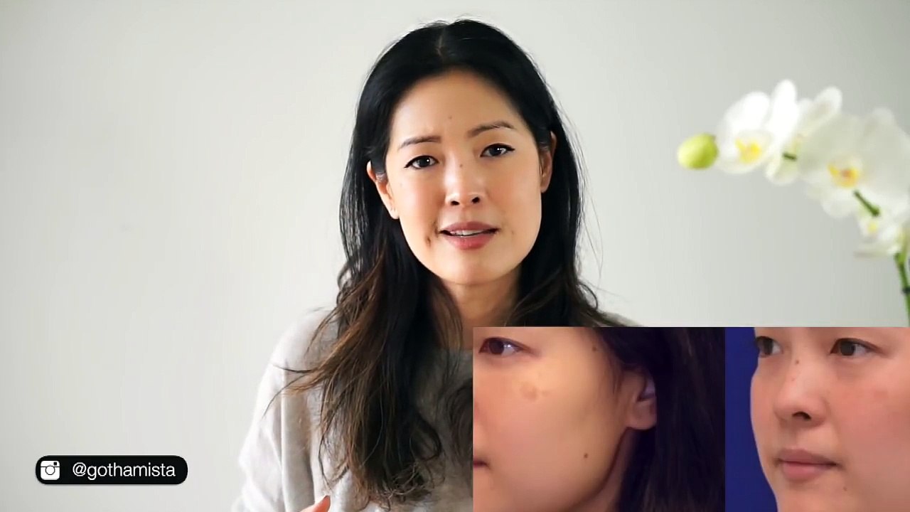Treating Hyperpigmentation | How to Fade Dark Spots