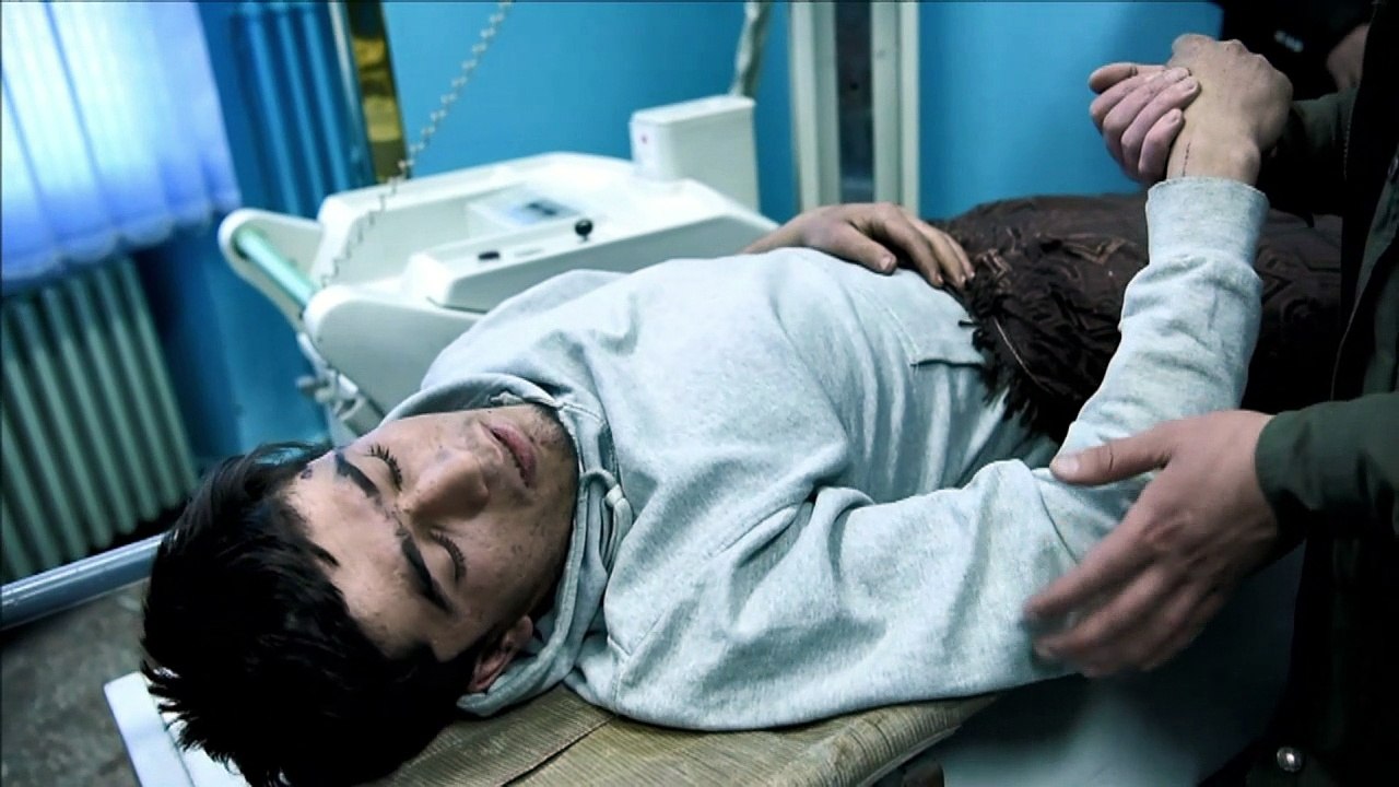 Injured employees recover at hospital after Kabul hotel attack