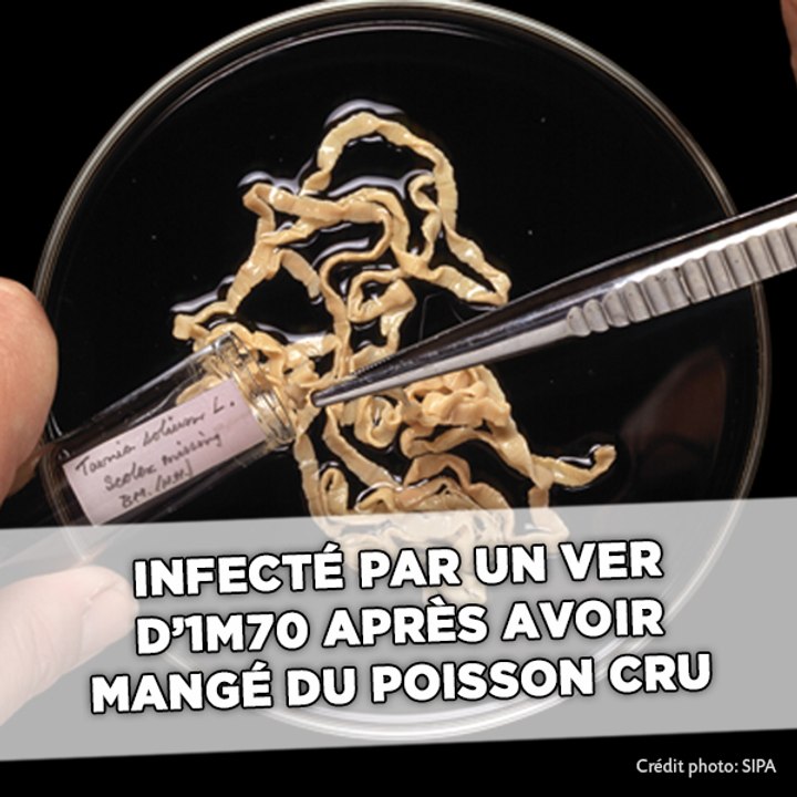 Infecté par un ver parasite d'1,70 mètre après avoir mangé des sushis quotidiennement