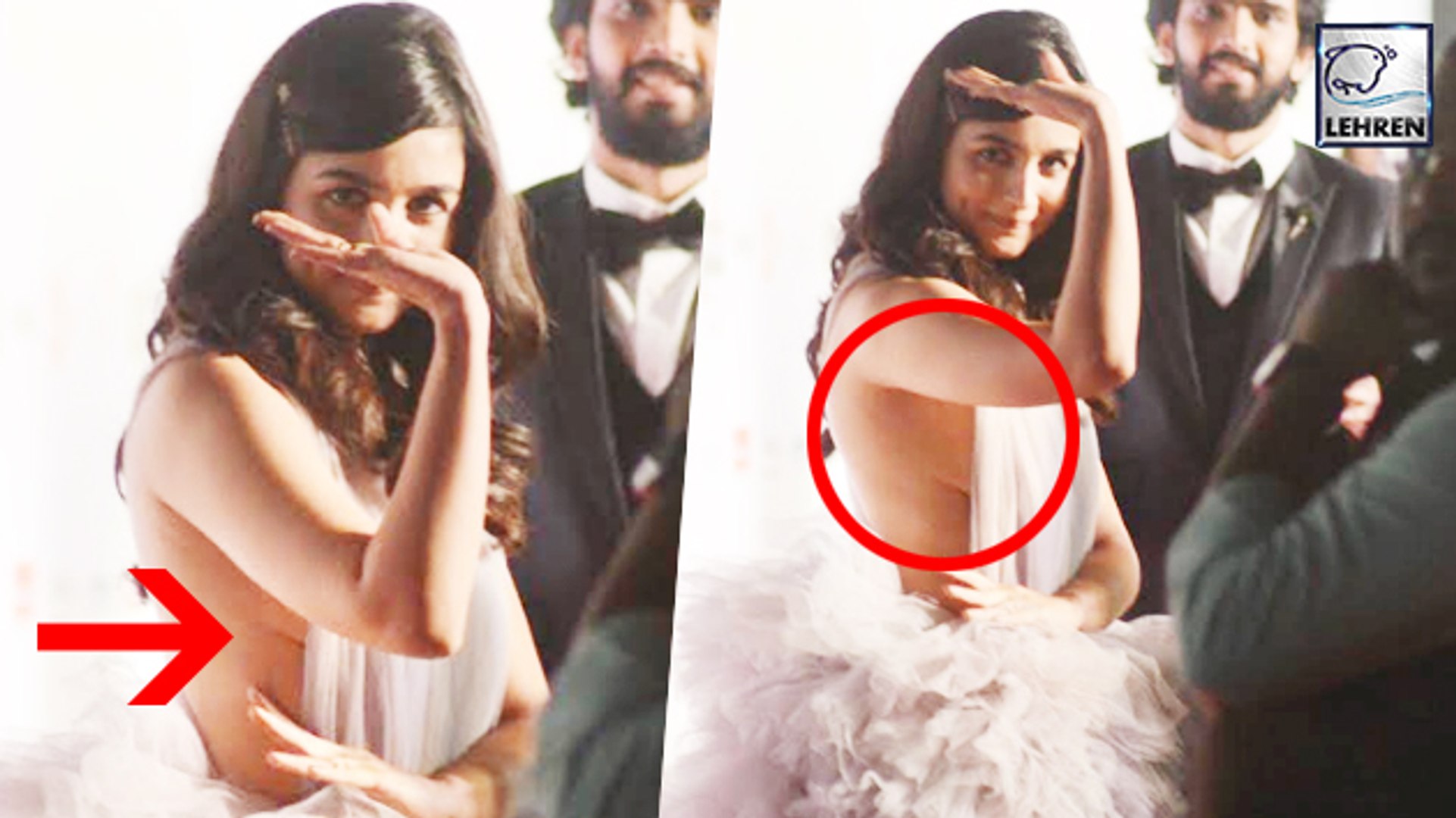 Alia Bhatt S Wardrobe Malfunction At Filmfare Awards 2018 Video